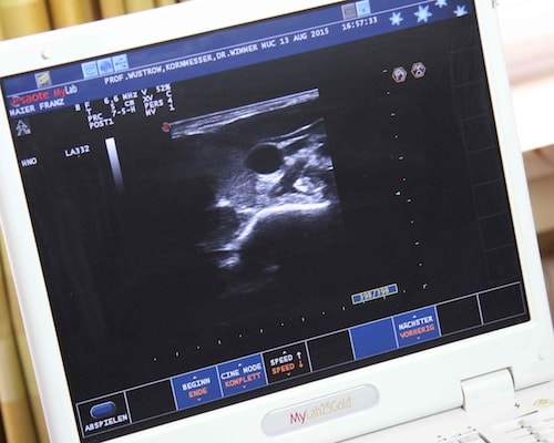 Bildgebende Diagnostik Ultraschall be - Bildgebende Diagnostik München